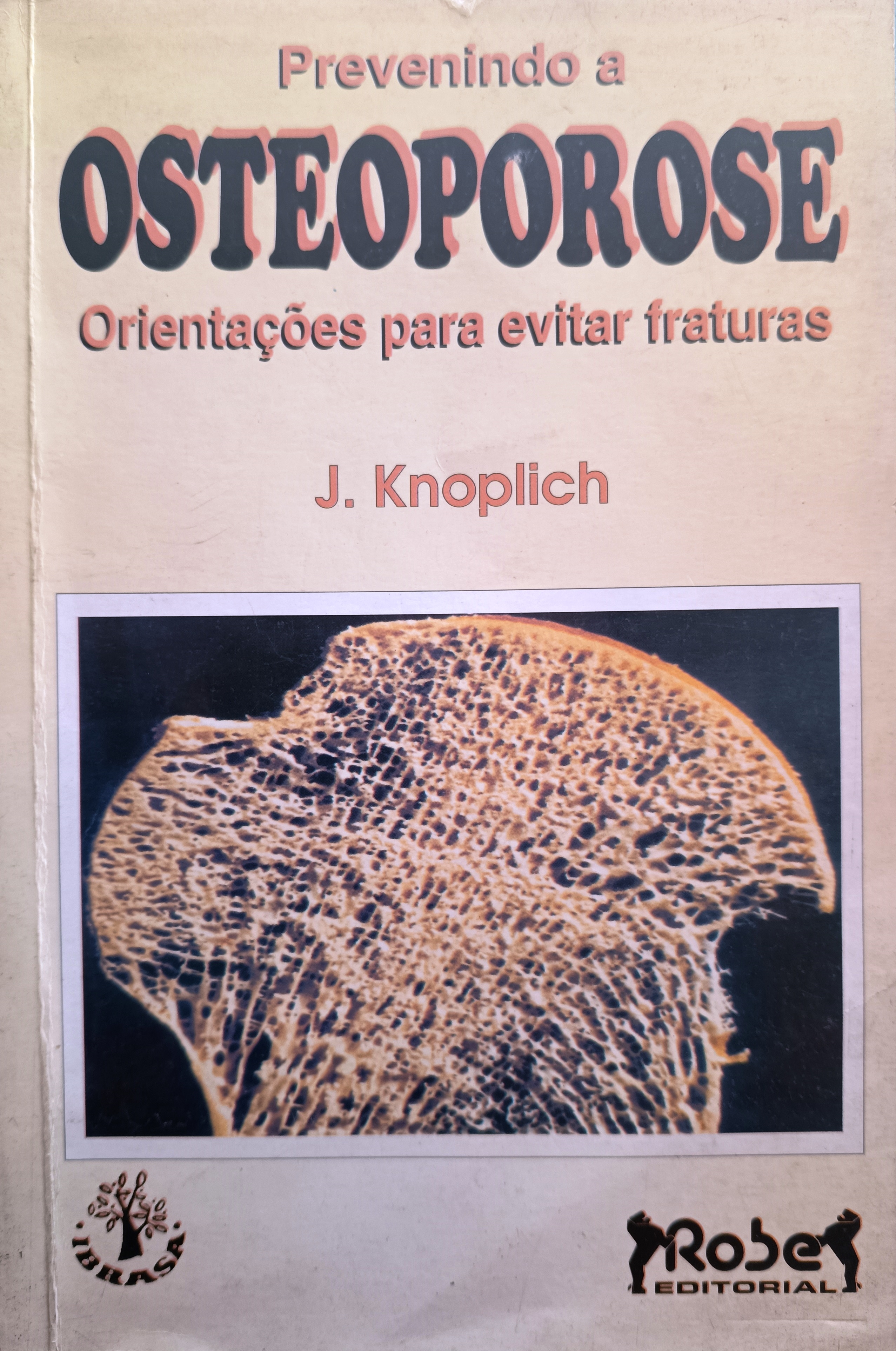 Prevenindo a Osteoporose - Orientações para evitar fraturas - Jose Knoplich 